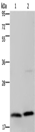 Anti-Human MCTS1 Antibody - ABMIUM