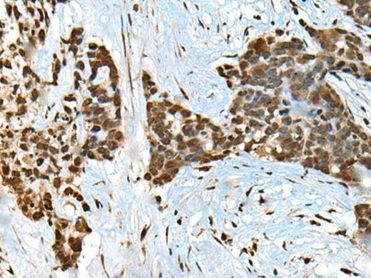 Anti-Human/Mouse CCDC12 Antibody