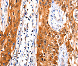 Anti-Human FBLN1 Antibody - ABMIUM