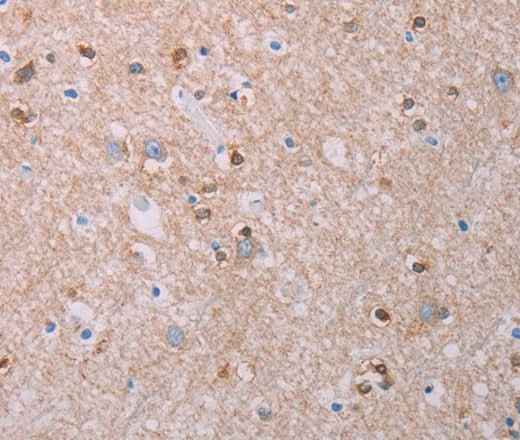 Anti-Human/Mouse/Rat AKT2 Antibody