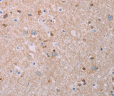 Anti-Human/Mouse/Rat AKT2 Antibody - ABMIUM