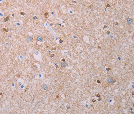 Anti-Human/Mouse/Rat AKT2 Antibody - ABMIUM