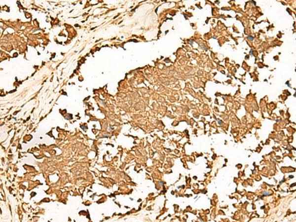 Anti-Human/Mouse PWP1 Antibody