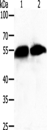 Anti-Human GC Antibody - ABMIUM