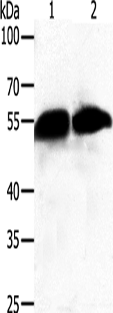 Anti-Human GC Antibody - ABMIUM