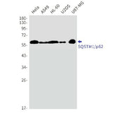 Western blot detection of SQSTM1/p62 in A549,HL-60,U2OS cell lysates using SQSTM1/p62 Rabbit mAb(1:1000 diluted).Predicted band size:48kDa.Observed band size:62kDa.