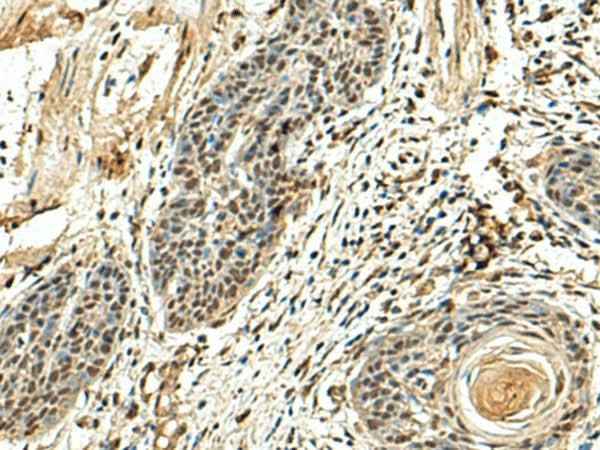 Anti-Human/Mouse/Rat NUTF2 Antibody
