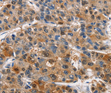 Anti-Human/Mouse/Rat PIM1 Antibody - ABMIUM
