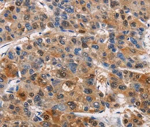 Anti-Human/Mouse/Rat PIM1 Antibody