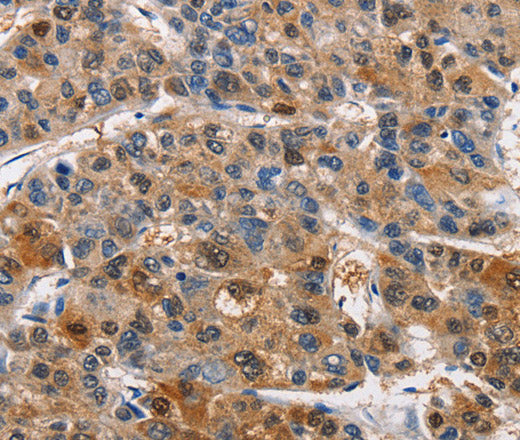 Anti-Human/Mouse/Rat PIM1 Antibody - ABMIUM
