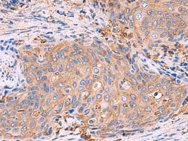 Anti-Human/Mouse/Rat G6PC Antibody