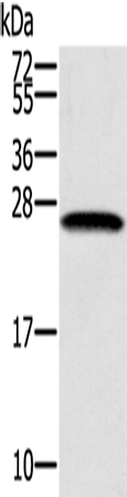Anti-Human SSX1 Antibody - ABMIUM