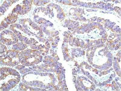Anti-Human/Mouse/Rat STAT1 Mouse (12E8) Antibody [12E8]