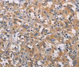 Anti-Human/Mouse PIKFYVE Antibody - ABMIUM