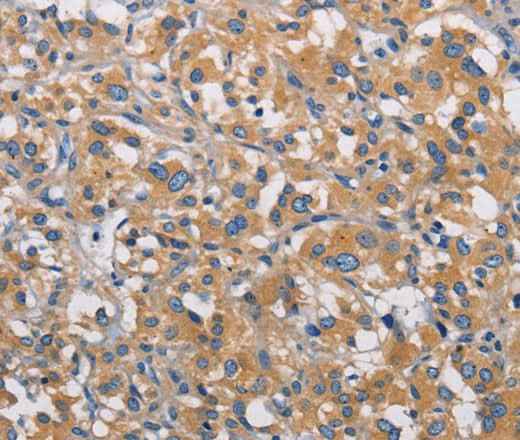 Anti-Human/Mouse PIKFYVE Antibody