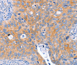 Anti-Human ABO Antibody - ABMIUM