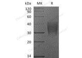 > 95 % as determined by reducing SDS-PAGE.
