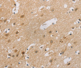 Anti-Human CDKN2A Antibody - ABMIUM