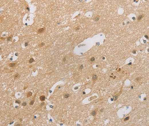 Anti-Human CDKN2A Antibody