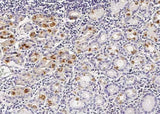Anti-Human CDH5 Antibody [B103] - ABMIUM