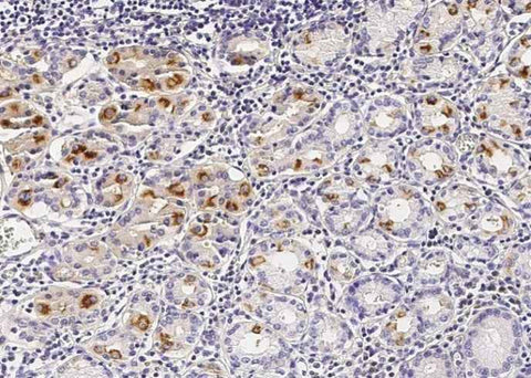Anti-Human CDH5 Antibody [B103] - ABMIUM