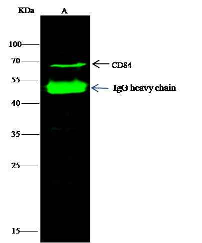 Anti-Human CD84 Antibody [A1207] - ABMIUM