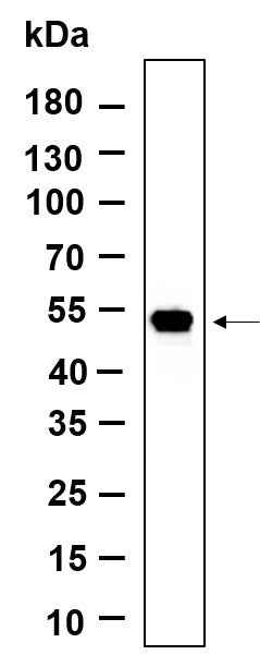 Anti-Human/Mouse/Rat LOX Antibody [B916] - ABMIUM