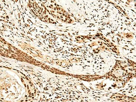 Anti-Human/Mouse METTL1 Antibody