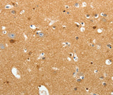Anti-Human/Mouse/Rat TNR Antibody - ABMIUM