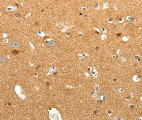 Anti-Human/Mouse/Rat TNR Antibody
