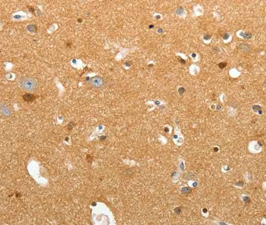 Anti-Human/Mouse/Rat TNR Antibody