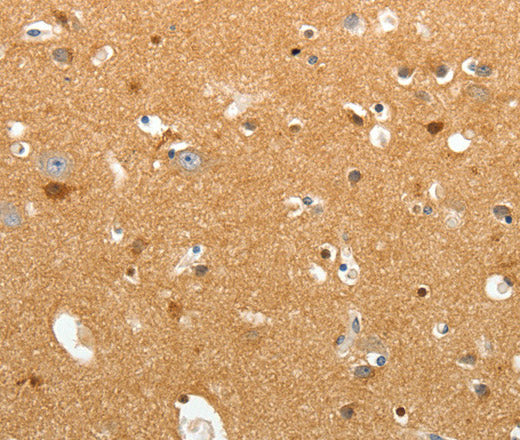 Anti-Human/Mouse/Rat TNR Antibody - ABMIUM