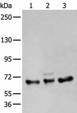 Western blot analysis of A431 K562 and TM4 cell lysates using ZBTB5 Polyclonal Antibody at dilution of 1:400