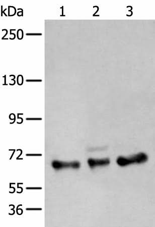 Western blot analysis of A431 K562 and TM4 cell lysates using ZBTB5 Polyclonal Antibody at dilution of 1:400