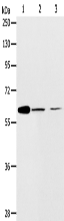 Anti-Human/Mouse ABCE1 Antibody - ABMIUM