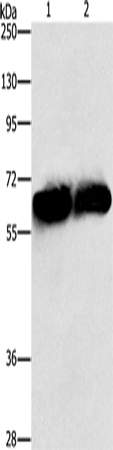 Anti-Human/Mouse/Rat ASNS Antibody - ABMIUM