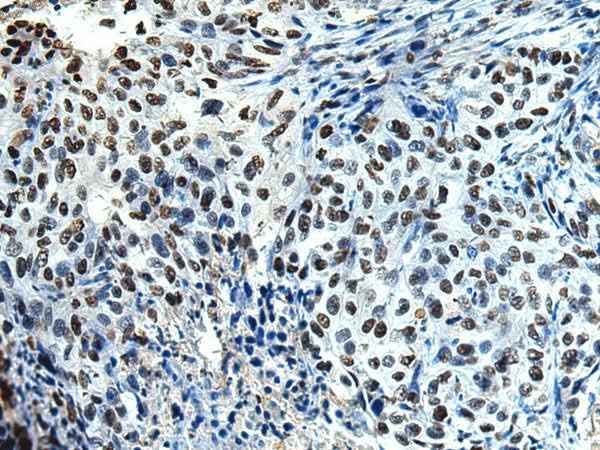 Anti-Human/Mouse/Rat DDX39A Antibody