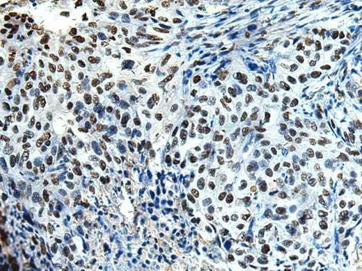 Anti-Human/Mouse/Rat DDX39A Antibody