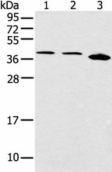 Western blot analysis of Jurkat Hela and 231 cell using CCNG1 Polyclonal Antibody at dilution of 1:400