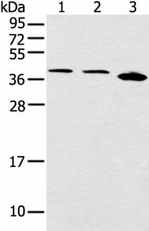 Western blot analysis of Jurkat Hela and 231 cell using CCNG1 Polyclonal Antibody at dilution of 1:400