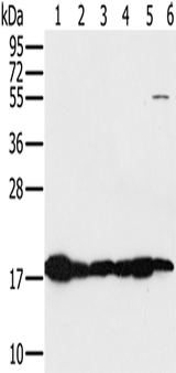 Anti-Human/Mouse MTFP1 Antibody - ABMIUM