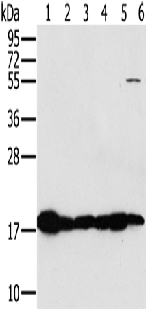 Anti-Human/Mouse MTFP1 Antibody - ABMIUM
