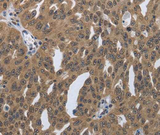 Anti-Human/Mouse/Rat PRKAR1B Antibody