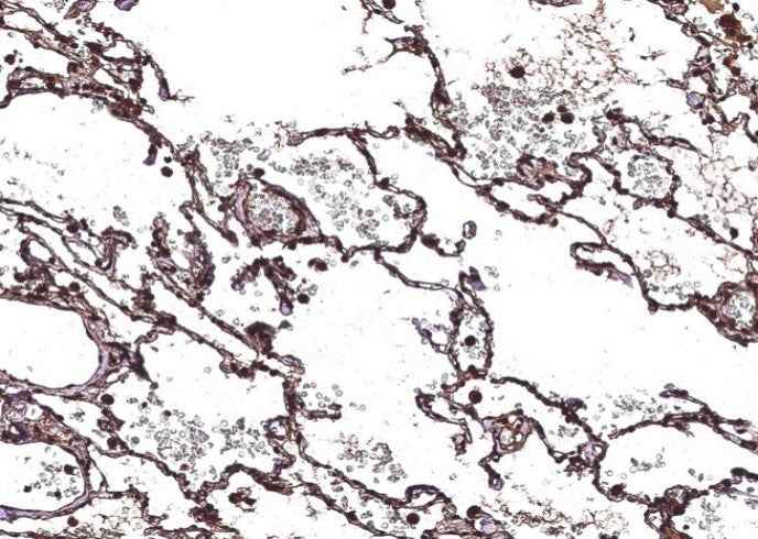 Anti-Human CHI3L2 Antibody [B167] - ABMIUM