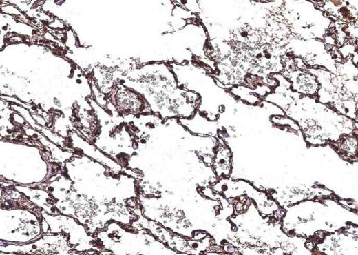 Anti-Human CHI3L2 Antibody [B167] - ABMIUM
