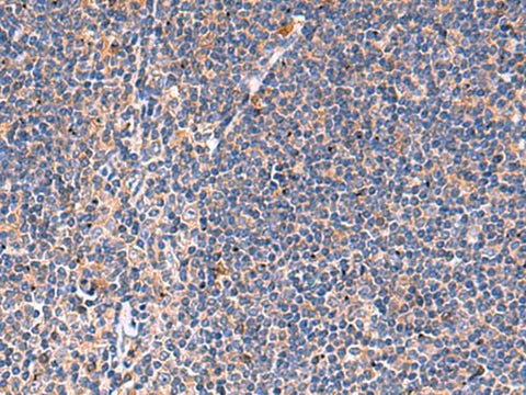 Immunohistochemistry of paraffin-embedded Human tonsil tissue using KLK9 Polyclonal Antibody at dilution of 1:50(×200)