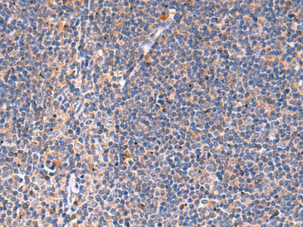 Immunohistochemistry of paraffin-embedded Human tonsil tissue using KLK9 Polyclonal Antibody at dilution of 1:50(×200)
