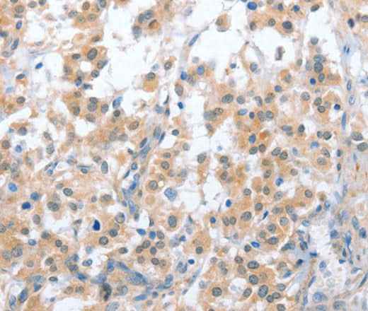 Anti-Human CD200R1 Antibody