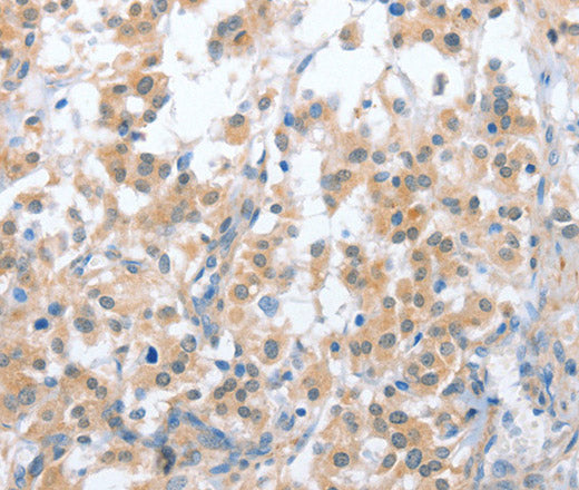 Anti-Human CD200R1 Antibody - ABMIUM