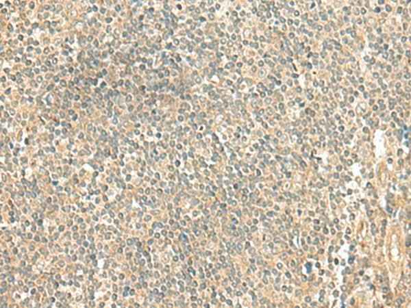 Anti-Human/Mouse/Rat LMO3 Antibody